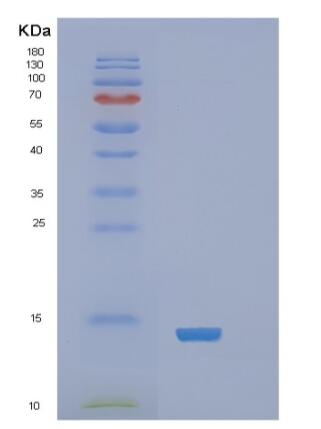 Recombinant Human RARα Protein,Recombinant Human RARα Protein