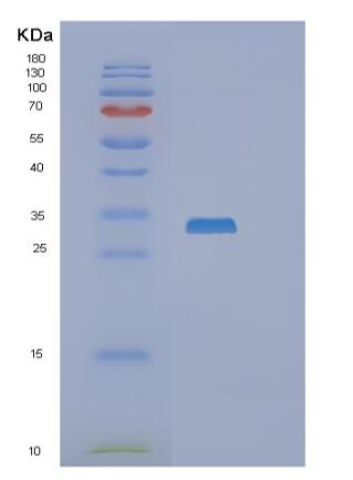 Recombinant Human RASL12 Protein,Recombinant Human RASL12 Protein