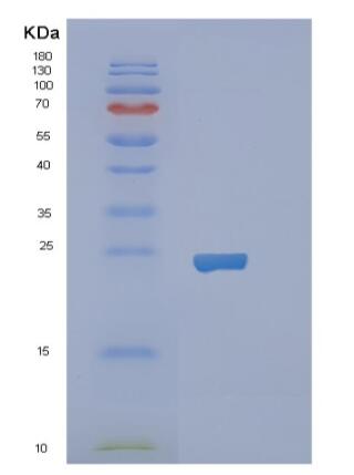 Recombinant Human RBP1 Protein,Recombinant Human RBP1 Protein