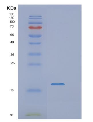 Recombinant Human RBP5 Protein,Recombinant Human RBP5 Protein