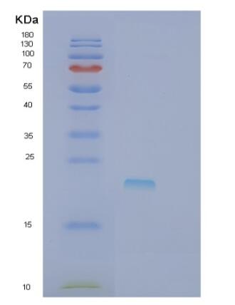 Recombinant Human RCAN3 Protein,Recombinant Human RCAN3 Protein