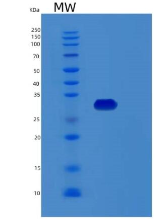 Recombinant Human RCHY1 Protein,Recombinant Human RCHY1 Protein