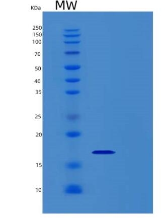 Recombinant Human REG4 Protein,Recombinant Human REG4 Protein