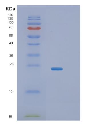 Recombinant Human RERG Protein,Recombinant Human RERG Protein