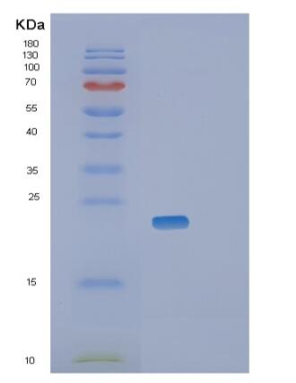 Recombinant Mouse Retinol-binding protein 4 Protein,Recombinant Mouse Retinol-binding protein 4 Protein