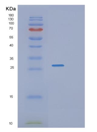 Recombinant Human RGS1 Protein,Recombinant Human RGS1 Protein