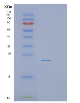 Recombinant Human RGS10 Protein,Recombinant Human RGS10 Protein