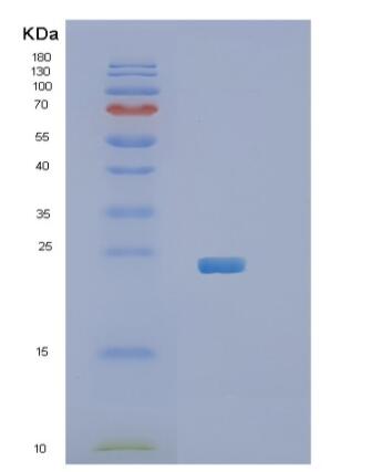 Recombinant Human RGS5 Protein,Recombinant Human RGS5 Protein