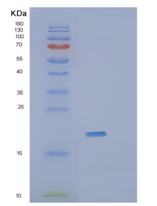 Recombinant Human RheB Protein,Recombinant Human RheB Protein