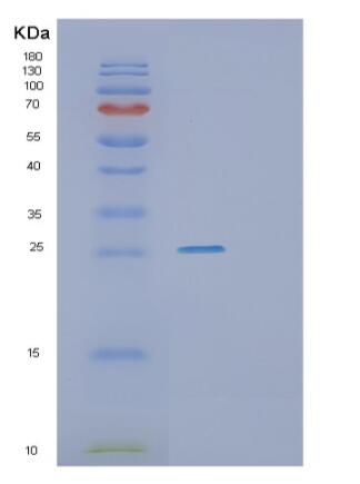 Recombinant Human RHOA Protein,Recombinant Human RHOA Protein