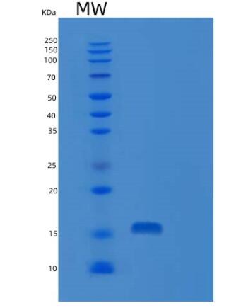 Recombinant Human RNASE7 Protein,Recombinant Human RNASE7 Protein