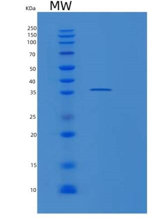 Recombinant Human RNASEH2A Protein,Recombinant Human RNASEH2A Protein