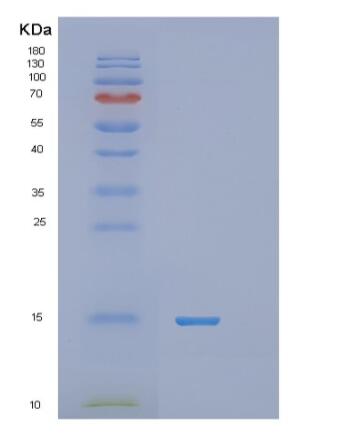 Recombinant Human RNF7 Protein,Recombinant Human RNF7 Protein