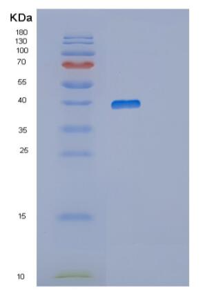 Recombinant Human RNLS Protein,Recombinant Human RNLS Protein