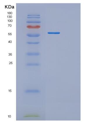 Recombinant Human RNMT Protein,Recombinant Human RNMT Protein