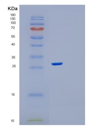 Recombinant Human RPE Protein,Recombinant Human RPE Protein