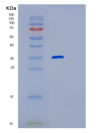 Recombinant Human RPIA Protein,Recombinant Human RPIA Protein