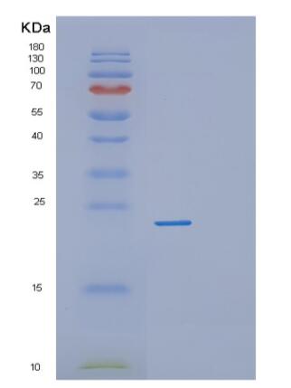 Recombinant Human RPL18A Protein,Recombinant Human RPL18A Protein