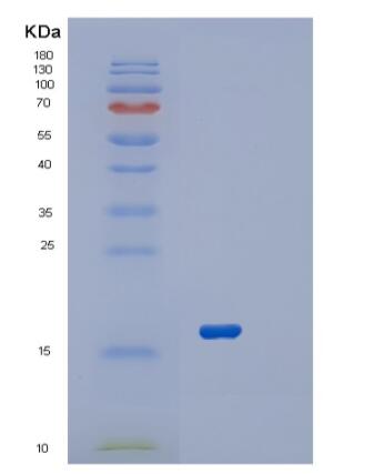 Recombinant Human RPL22 Protein,Recombinant Human RPL22 Protein