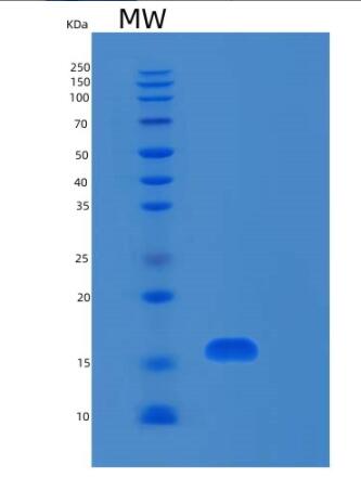 Recombinant Human RPL31 Protein,Recombinant Human RPL31 Protein