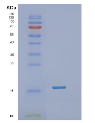 Recombinant Human RBP2 Protein,Recombinant Human RBP2 Protein
