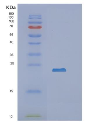 Recombinant Human RBP4 Protein,Recombinant Human RBP4 Protein