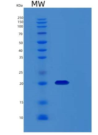 Recombinant HumanRCL Protein,Recombinant HumanRCL Protein
