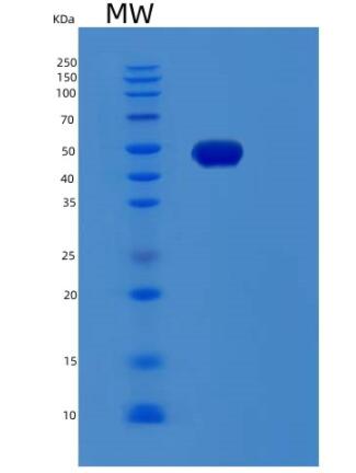 Recombinant Human RDBP Protein,Recombinant Human RDBP Protein