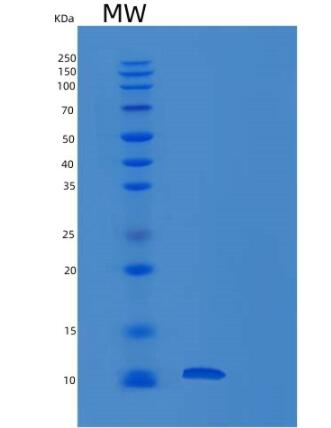 Recombinant Human RETN Protein,Recombinant Human RETN Protein