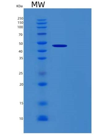 Recombinant Human RBM17 Protein,Recombinant Human RBM17 Protein