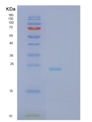 Recombinant Human RCAN2 Protein,Recombinant Human RCAN2 Protein