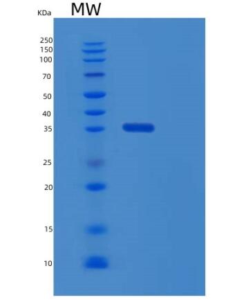 Recombinant Human RGN Protein,Recombinant Human RGN Protein