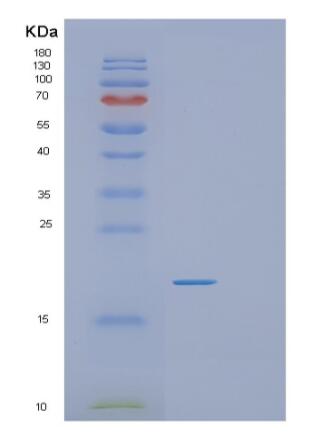 Recombinant Human RGS21 Protein,Recombinant Human RGS21 Protein