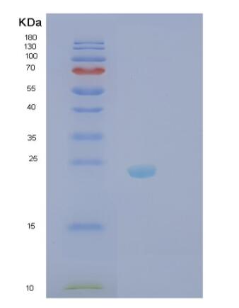 Recombinant Human RhoC Protein,Recombinant Human RhoC Protein