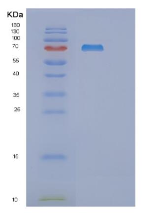 Recombinant Human RNGTT Protein,Recombinant Human RNGTT Protein