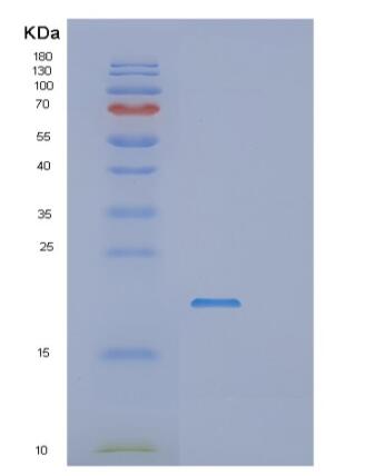 Recombinant E.coli rnhA Protein,Recombinant E.coli rnhA Protein