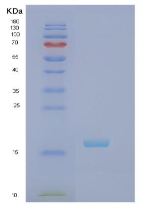 Recombinant Human RBP7 Protein,Recombinant Human RBP7 Protein