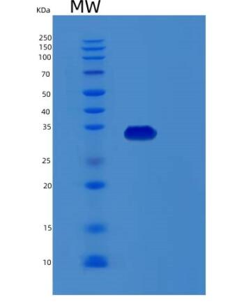 Recombinant Human RDH12 Protein,Recombinant Human RDH12 Protein