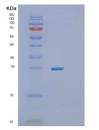 Recombinant Human RGS16 Protein,Recombinant Human RGS16 Protein