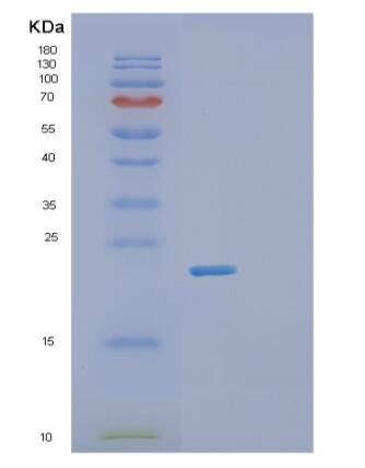 Recombinant Human RhoB Protein,Recombinant Human RhoB Protein