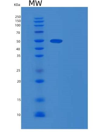 Recombinant Human RNMTL1 Protein,Recombinant Human RNMTL1 Protein