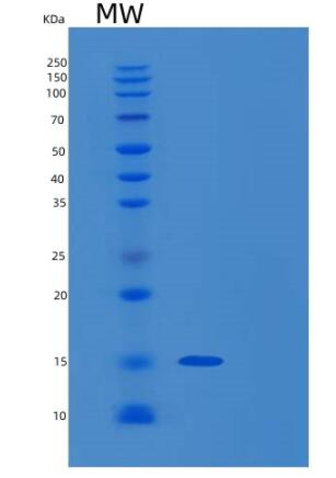 Recombinant Human ROBLD3 Protein,Recombinant Human ROBLD3 Protein