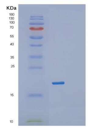 Recombinant Human RPL12 Protein,Recombinant Human RPL12 Protein