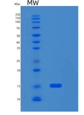 Recombinant Human RPL35 Protein,Recombinant Human RPL35 Protein