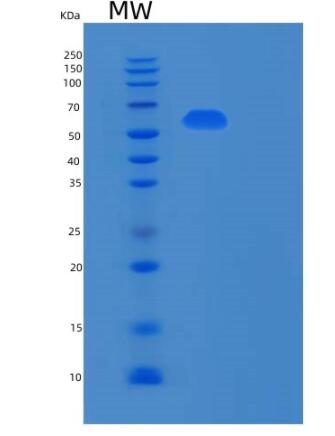 Recombinant Human RPN2 Protein,Recombinant Human RPN2 Protein