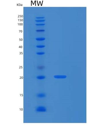 Recombinant Human RPS10 Protein,Recombinant Human RPS10 Protein