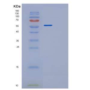 Recombinant Human PRMT3 Protein