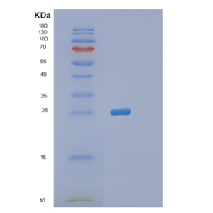 Recombinant Human PRNP Protein