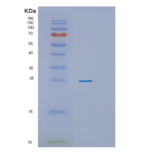 Recombinant Human PROCR Protein
