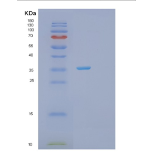 Recombinant Human PRPS1 Protein,Recombinant Human PRPS1 Protein